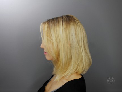 nachher LongBob Seitenansicht links